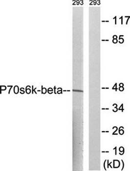 p70 S6 Kinase β (Ab-423) Antibody