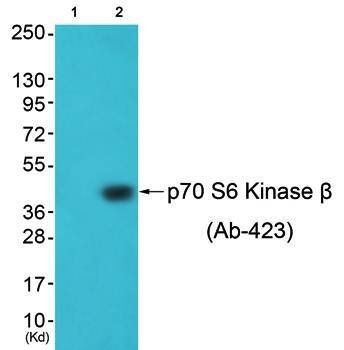 p70 S6 Kinase β (Ab-423) Antibody