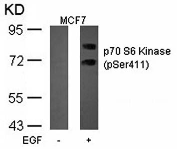 p70 S6 Kinase (Phospho-Ser411) Antibody