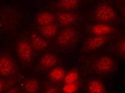 p70 S6 Kinase (Phospho-Thr421) Antibody