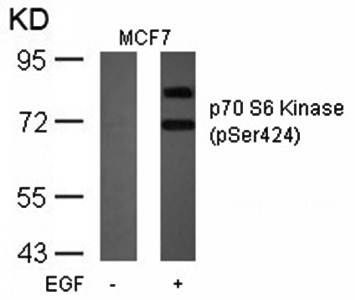 p70 S6 Kinase (Phospho-Ser424) Antibody