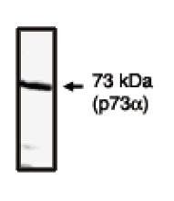 Rabbit Human p73 (C Terminal) Antibody