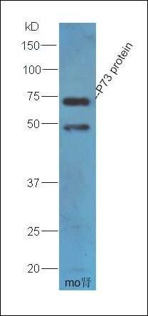p73 antibody