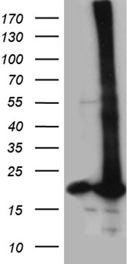 KIAA1524 Antibody