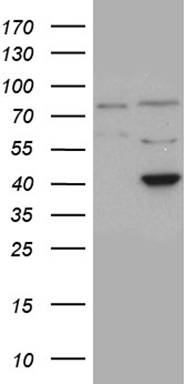 KIAA1524 Antibody