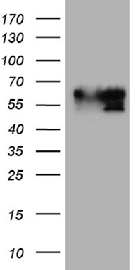 CIP2A Antibody