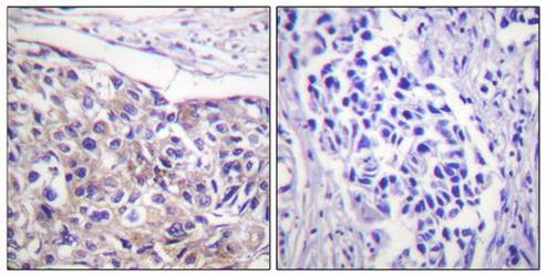 p90 RSK (phospho-Thr573) antibody