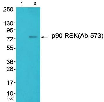 p90 RSK antibody