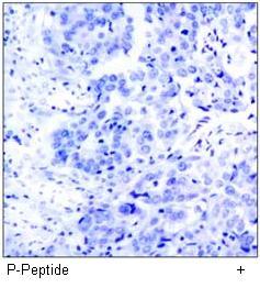 p90RSK (Phospho-Thr348) Antibody