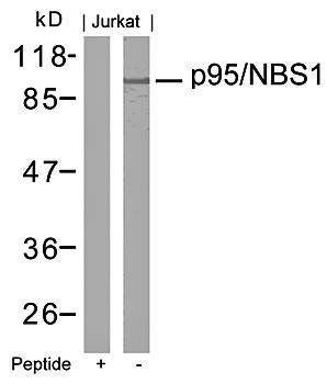 p95/NBS1 (Ab-343) Antibody