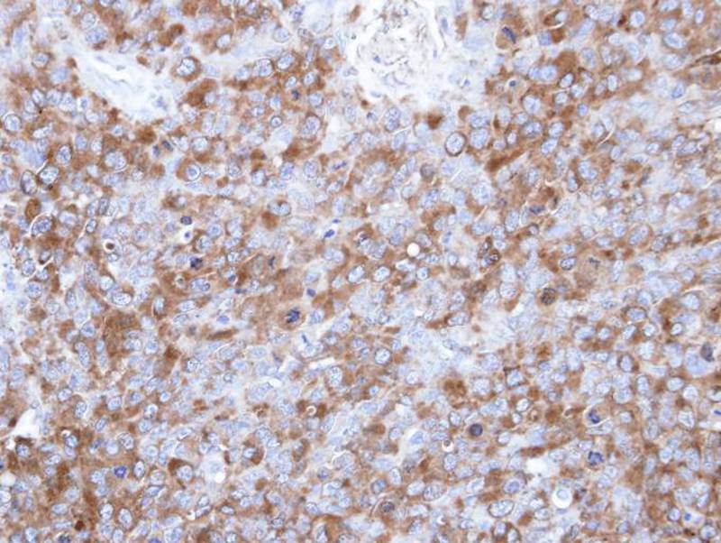 p-Tau antibody