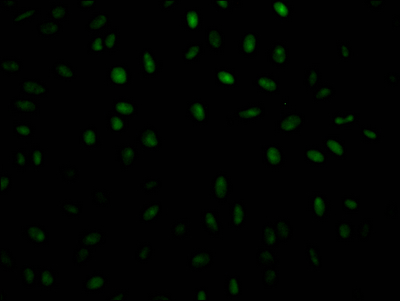 PABPN1 Recombinant Monoclonal Antibody