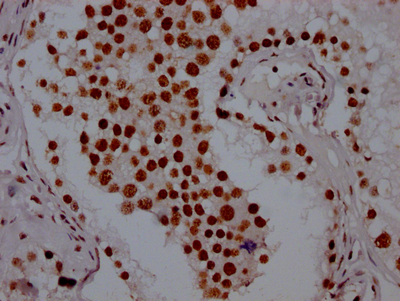 PABPN1 Recombinant Monoclonal Antibody