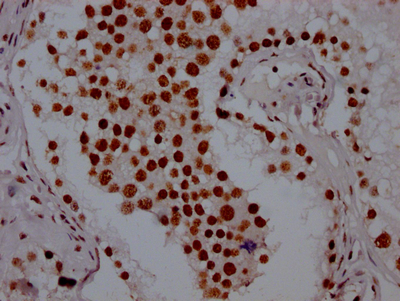 PABPN1 antibody