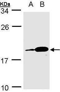 PACAP antibody [N1C3]