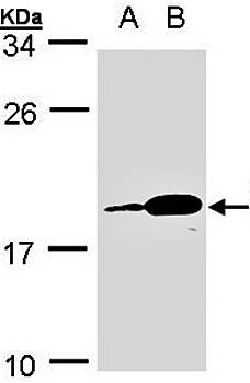 PACAP Rabbit Polyclonal Antibody