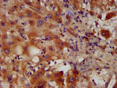 PACS2 Antibody