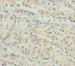 PACSIN2 antibody