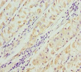 PACSIN2 Antibody