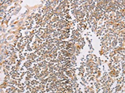 PACSIN2 Antibody