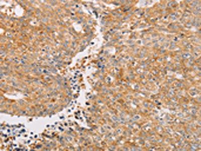 PACSIN2 Antibody