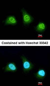PAD4 antibody