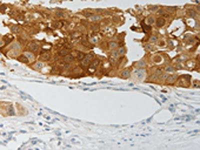 PADI4 Antibody