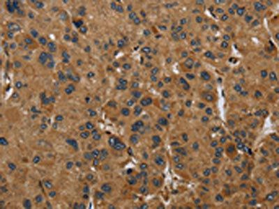 PAEP Antibody
