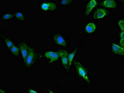 PAFAH1B1 Antibody