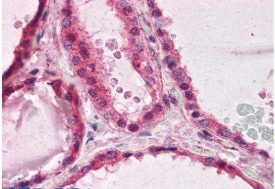 Goat anti-LIS1 / PAFAH1B1 Antibody