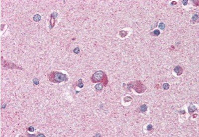 Goat anti-LIS1 / PAFAH1B1 Antibody