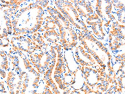 PAFAH2 Antibody