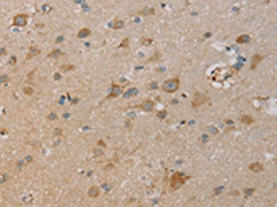 PAGE2 Antibody