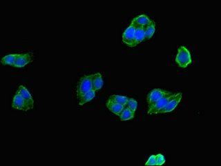 PAH antibody