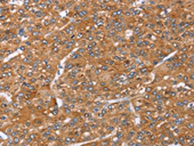 PAICS Antibody