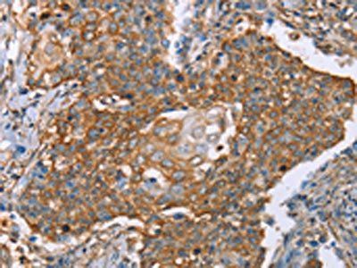 PAICS Antibody