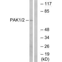 PAK1 (Ab-199) Antibody