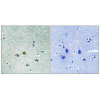 PAK1 (Ab-204) Antibody