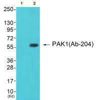 PAK1 (Ab-204) Antibody