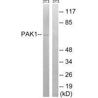 PAK1 (Ab-204) antibody