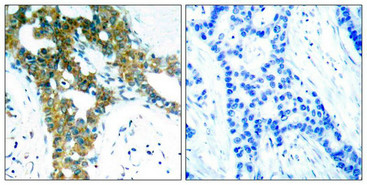 PAK1/PAK2/PAK3 (Ab-423/402/421) Antibody