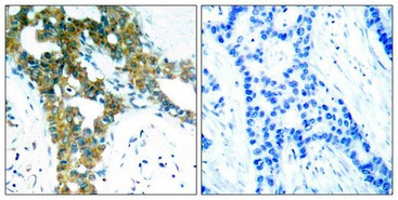 PAK1 (Ab-423/402/421) antibody