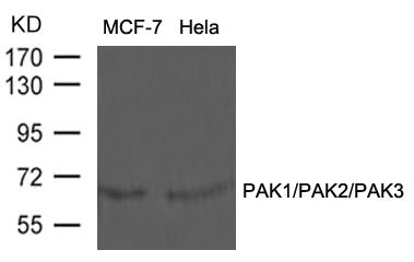 PAK1/PAK2/PAK3 (Ab-423/402/421) Antibody