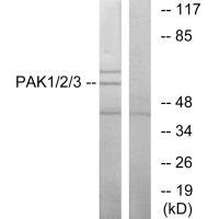 PAK1 (Ab-423/402/421) antibody