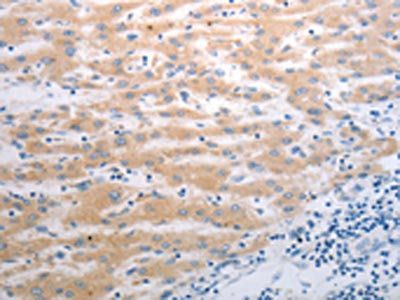 PAK1 Antibody