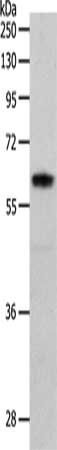 PAK1 Antibody