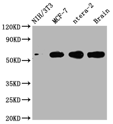 PAK1 Recombinant Monoclonal Antibody