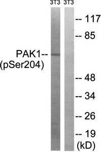 PAK1 (Phospho-Ser204) Antibody