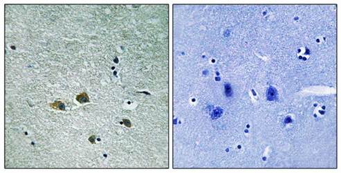 PAK1 (Ab-204) Antibody