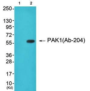 PAK1 (Ab-204) Antibody